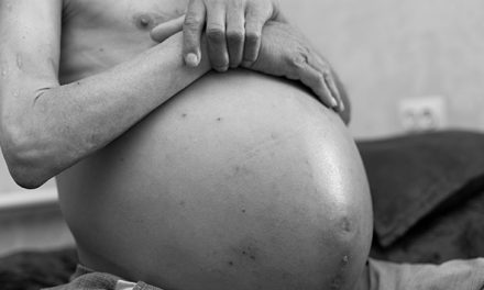 Asites, Penumpukan Cairan Di Rongga Perut Perlu Di Waspadai